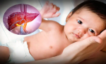 Sở Y tế TP.HCM khuyến cáo về dịch viêm gan cấp gây tử vong ở trẻ em