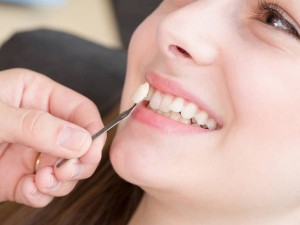 Trồng răng khểnh bằng nhựa và răng kém chất lượng tác hại khôn lường