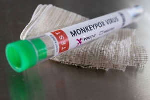 Thông tin mới nhất về sức khỏe của nữ bệnh nhân mắc bệnh đậu mùa khỉ đầu tiên ở Việt Nam