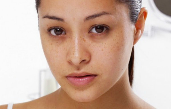 6 sai lầm trong ăn kiêng tàn phá làn da của bạn