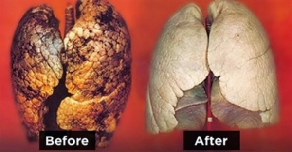 Hút thuốc lá trên 5 năm, hãy thanh lọc theo cách này để cứu phổi