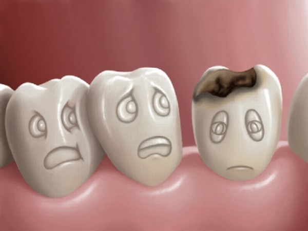 5 cách chữa đau răng tạm thời hiệu quả ngay tức thì