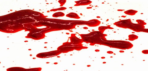 Bất ngờ về lý do khiến nhiều người nhìn thấy máu là ngất xỉu