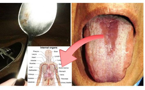 Đặt thìa inox lên lưỡi để biết cơ thể bị nhiễm độc gì chỉ sau 1 phút