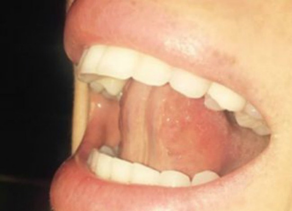 Cả đời có lẽ bạn không nghĩ đặt lưỡi phía sau răng lại có tác dụng tuyệt vời thế