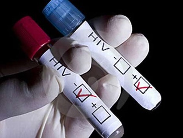 Lần đầu tiên áp dụng tự xét nghiệm HIV tại Việt Nam
