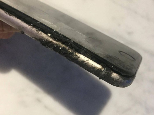 Tín đồ Apple suýt mất đùi phải vì iPhone 6 phát nổ trong túi quần