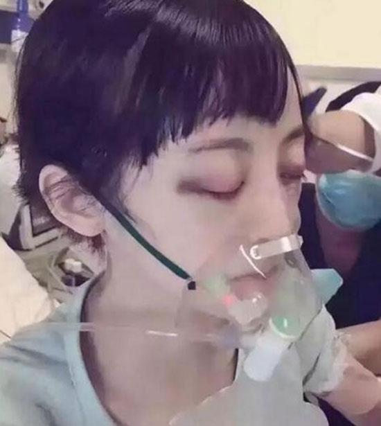 Nữ diễn viên trẻ Trung Quốc chết thảm vì trị ung thư bằng... giác hơi
