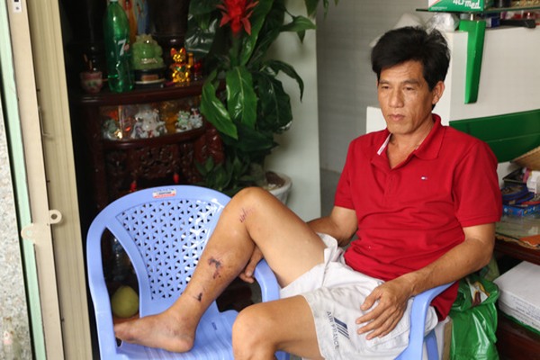 Vụ tai nạn Bảo Lộc: Triệu tập chủ xe khách để điều tra