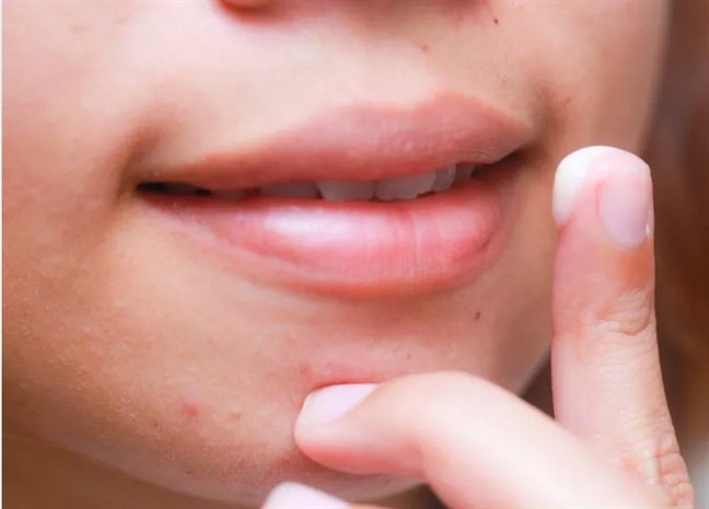 8 bước tẩy tế bào da chết CỰC CHUẨN cho đôi môi quyến rũ