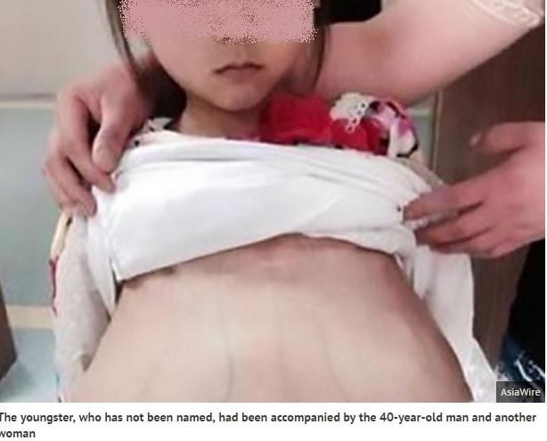 Bé gái 12 tuổi mang thai ở Trung Quốc là người Việt Nam bị bán làm vợ