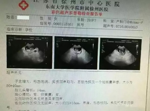 Cảnh sát Trung Quốc khẳng định bé gái 12 tuổi mang thai là người Việt và bị bắt cóc