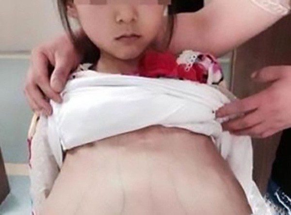 Cảnh sát Trung Quốc khẳng định bé gái 12 tuổi mang thai là người Việt và bị bắt cóc