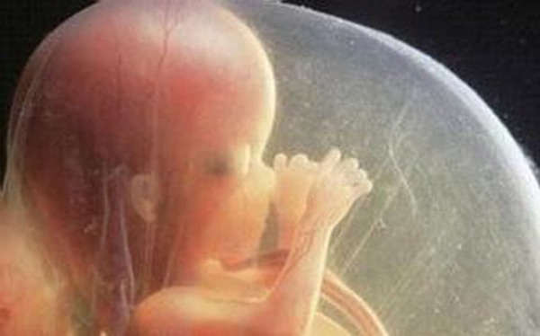 Làm móng lúc mang thai 3 tháng, mẹ đau đớn khi nhìn ảnh siêu âm thai