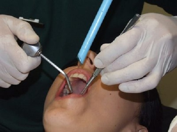 Nguy cơ nhiễm thủy ngân do hàn răng