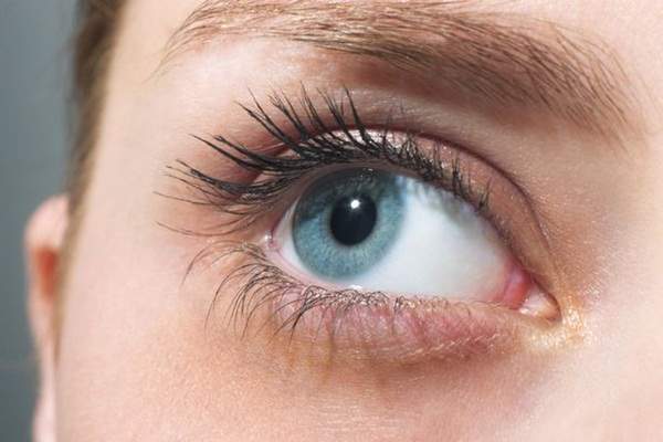 Hãy cảnh giác với vết quầng thâm dưới mắt vì có thể bạn đang bị bệnh