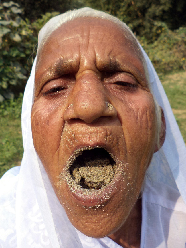 Bà cụ 78 tuổi ăn 2kg cát mỗi ngày suốt 6 thập kỷ qua