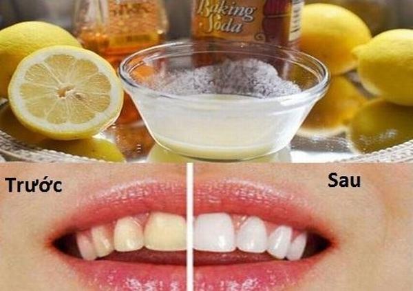Phương pháp tự nhiên xử lý hàm răng xỉn màu thành trắng sáng trong vài phút