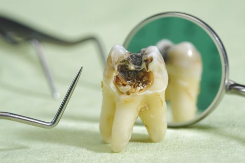 'Thuốc mọc răng': Tin vui cho những ai sợ nha sĩ
