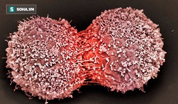 Ai cũng có tế bào ung thư trong cơ thể: 3 nguyên tắc vàng chặn đứng hình thành khối u