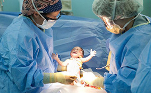 Bác sĩ cắt cụt ngón tay trẻ sơ sinh trong quá trình mổ lấy thai