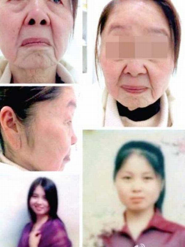 Dùng mỹ phẩm rẻ tiền, cô gái 28 tuổi đau khổ vì bị biến dạng thành bà lão 80