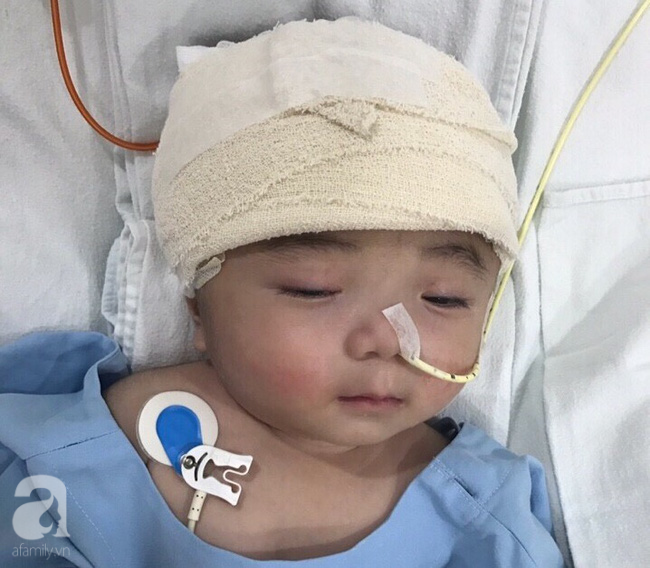 Một ngày sau cuộc tiểu phẫu, em bé não úng thuỷ Phạm Đức Lộc đã biết mở mắt, cử động tay chân