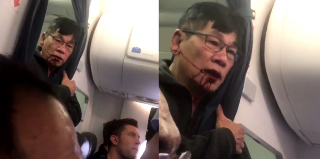 Hãng hàng không United Airlines bị chỉ trích vì 'lôi' hành khách khỏi máy bay