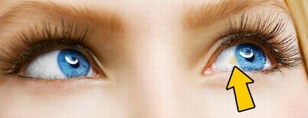 Phán đoán sức khoẻ thông qua đôi mắt