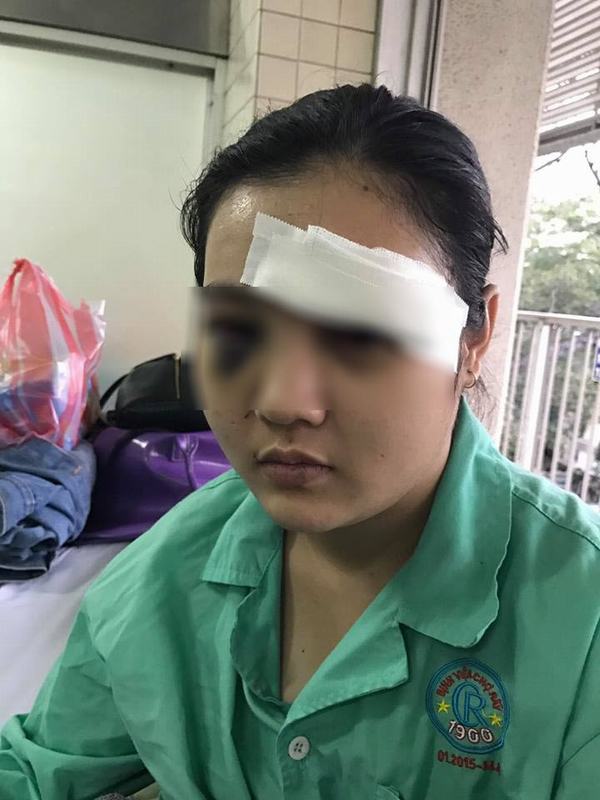 Sau khi tố giác tội phạm ăn cắp xe, cô gái xinh xắn sinh năm 2001 ở Sài Gòn bị gần 20 thanh niên hành hung dã man, cắt tai, đánh vỡ giác mạc mắt trái, đâm vào ngực... Chuyện do chị gái nạn nhân kể lại khiến dân mạng vô cùng phẫn nộ với nhóm thanh niên tàn độc.