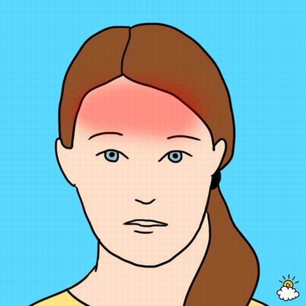10 kiểu đau đầu phổ biến và nguyên nhân gây ra chúng có thể khiến bạn ngạc nhiên