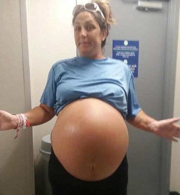 Mang bầu tăng cân rất ít nhưng lúc mổ đẻ, bác sĩ đã sốc khi thấy em bé thế này
