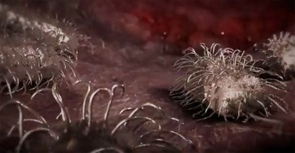 Vi khuẩn 'ăn thịt người' có thể giết chết bạn chỉ qua một vết xước
