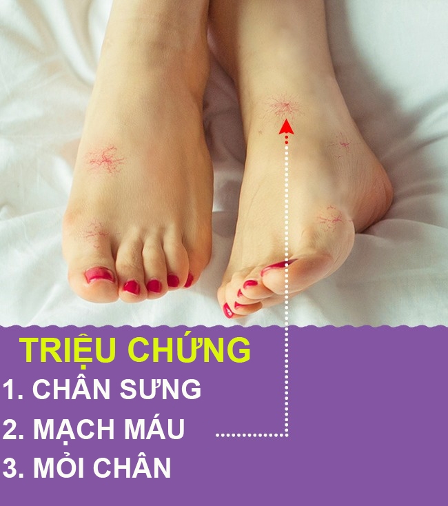 9 dấu hiệu thông qua bàn chân biết ngay sức khỏe bạn đang có vấn đề