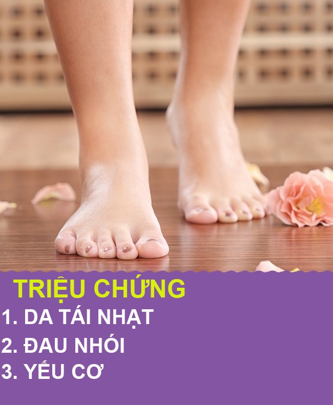 9 dấu hiệu thông qua bàn chân biết ngay sức khỏe bạn đang có vấn đề