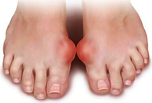 Bắt bệnh chuẩn xác thông qua những dấu hiệu bất thường ở bàn chân