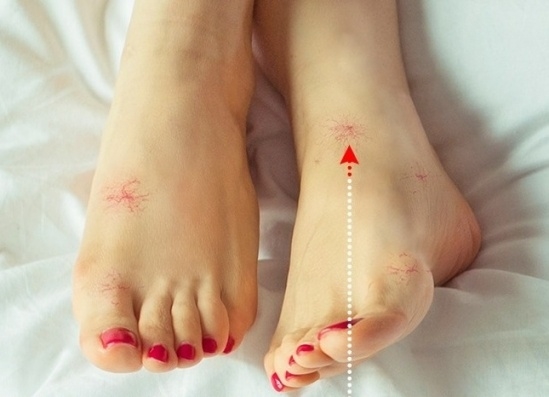 Bắt bệnh chuẩn xác thông qua những dấu hiệu bất thường ở bàn chân