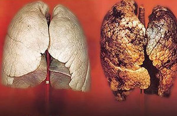 Bật mí loại quả ăn vào lọc sạch phổi cho người hút thuốc lá lâu năm ai cũng nên biết để tự cứu mình