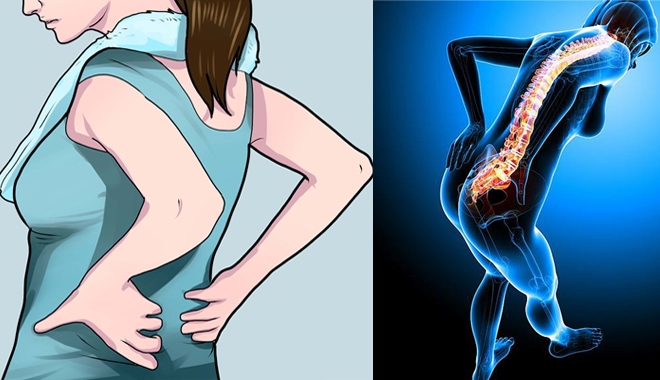 Chứng đau lưng cảnh báo 8 loại bệnh nguy hiểm
