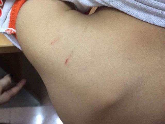 Cô giáo mầm non ở Hà Nội bạo hành con chồng: Phút kìm nén uất nghẹn của mẹ ruột khi quay clip bằng chứng