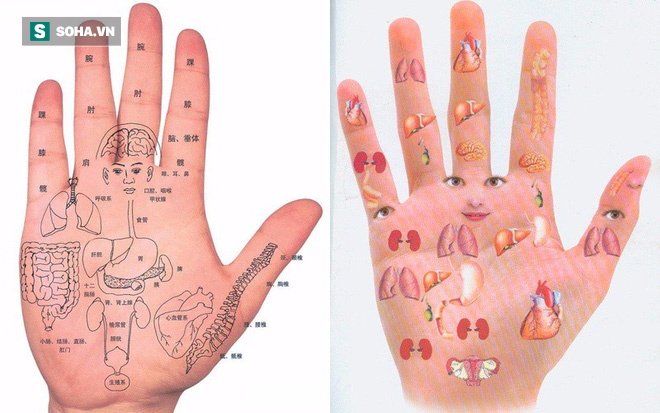 Một điểm trên bàn tay bị đỏ: Dấu hiệu cảnh báo bệnh gan không thể xem nhẹ