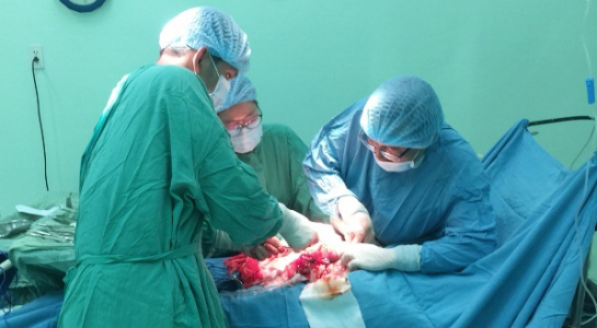 Phẫu thuật thành công khối u xơ tử cung to nặng gần 6 kg