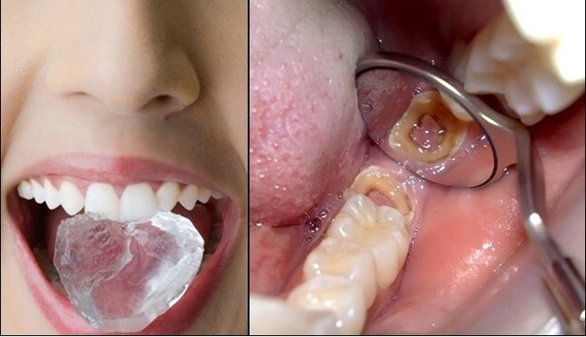 Những sai lầm ai cũng mắc khiến cho hàm răng ngày càng ố vàng