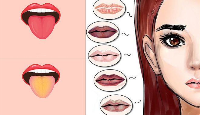 Tự chẩn đoán bệnh chính xác 90% chỉ cần nhìn màu môi và lưỡi