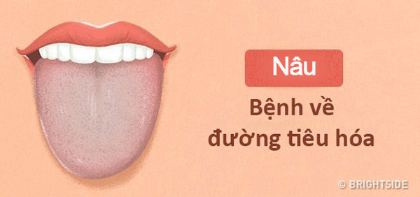 Tự chẩn đoán bệnh chính xác 90% chỉ cần nhìn màu môi và lưỡi