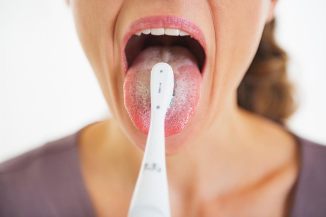 Dấu hiệu trên lưỡi cảnh báo cơ thể có bệnh nguy hiểm, nhìn lưỡi đoán bệnh để phòng ngừa sớm - Ảnh 1.