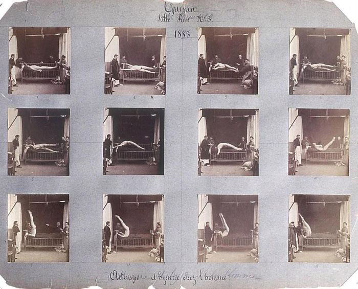 Những hình ảnh rùng mình tại một nhà thương điên thế kỷ 19 ở Pháp