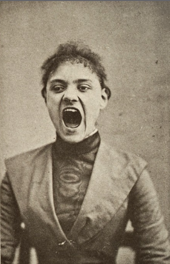 Những hình ảnh rùng mình tại một nhà thương điên thế kỷ 19 ở Pháp