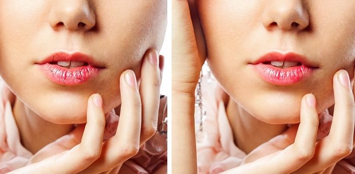 14 dấu hiệu bất thường trên khuôn mặt báo hiệu sức khoẻ bạn có vấn đề