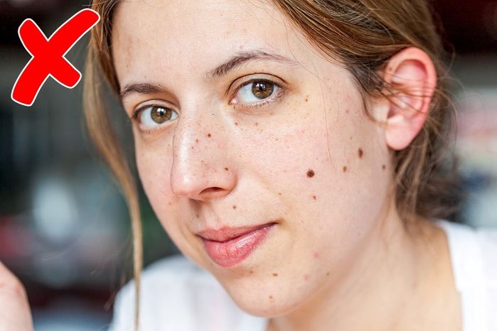 14 dấu hiệu bất thường trên khuôn mặt báo hiệu sức khoẻ bạn có vấn đề